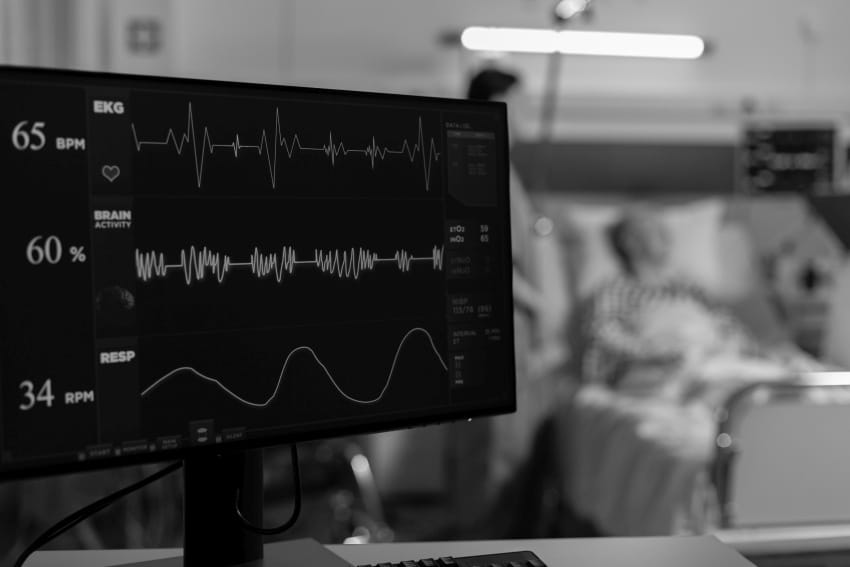 EKG monitor u bolničkoj sobi prikazuje srčanu i moždanu aktivnost dok pacijent leži u pozadini